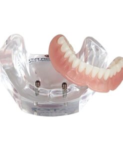 LOCATOR® R-Tx Education Patient Model - No Divergence