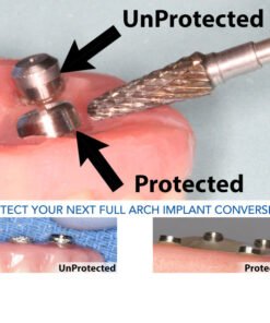 Bidra® Conversion Smart Polishing Cap