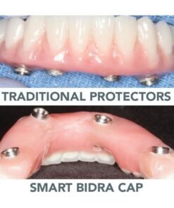 Bidra® Smart Polishing Cap Short
